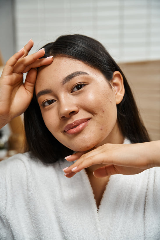 What are the best skincare products for treating acne?